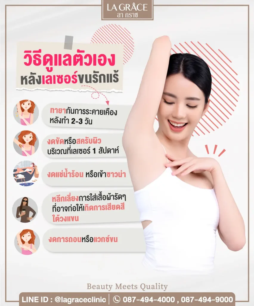 กำจัดขน