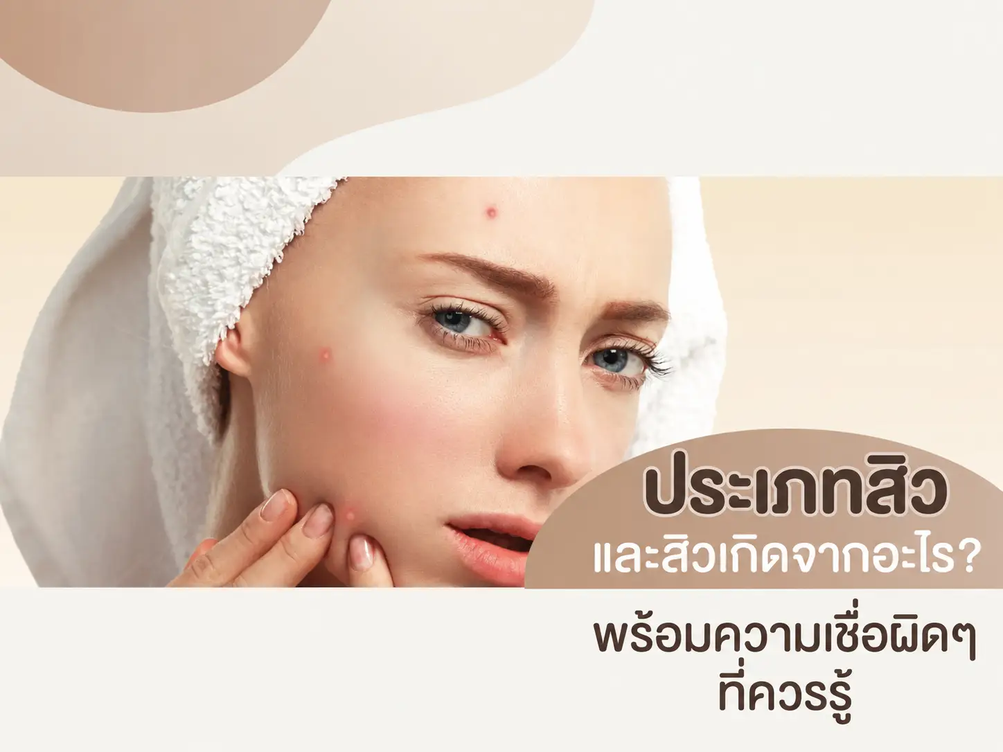 ประเภทสิว