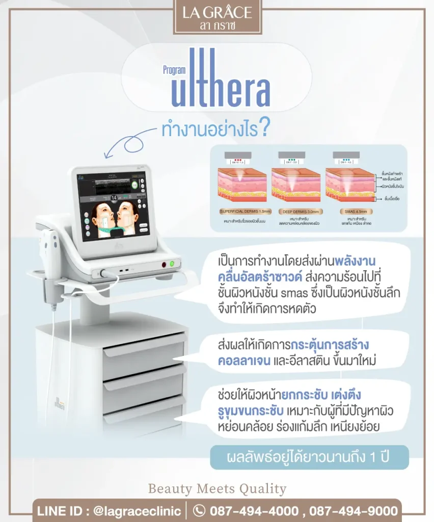 คอลลาเจน - Ulthera