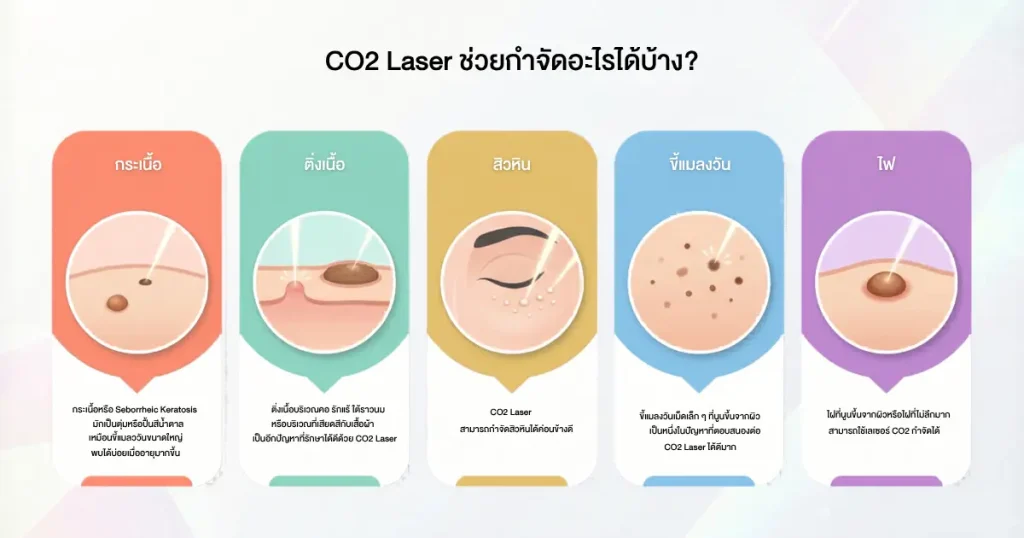 Co2 laser กำจัดไฝ ขี้แมลงวัน ติ่งเนื้อ กระเนื้อ สิวหิน