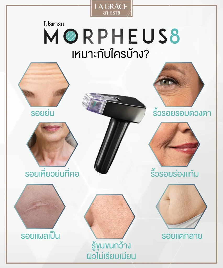 โปรแกรม ยกกระชับ  Morpheus 8