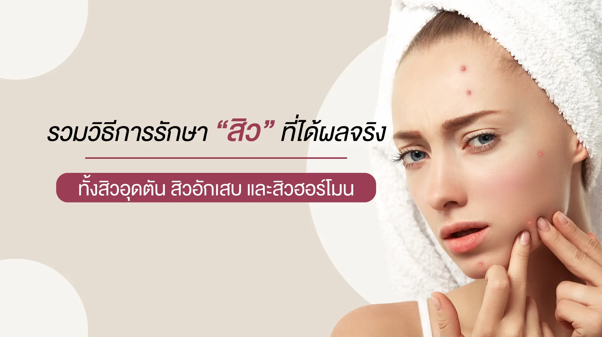 รักษาสิว