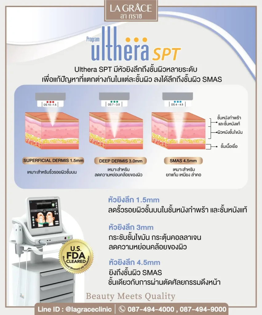 Ulthera  - working in different skin layer