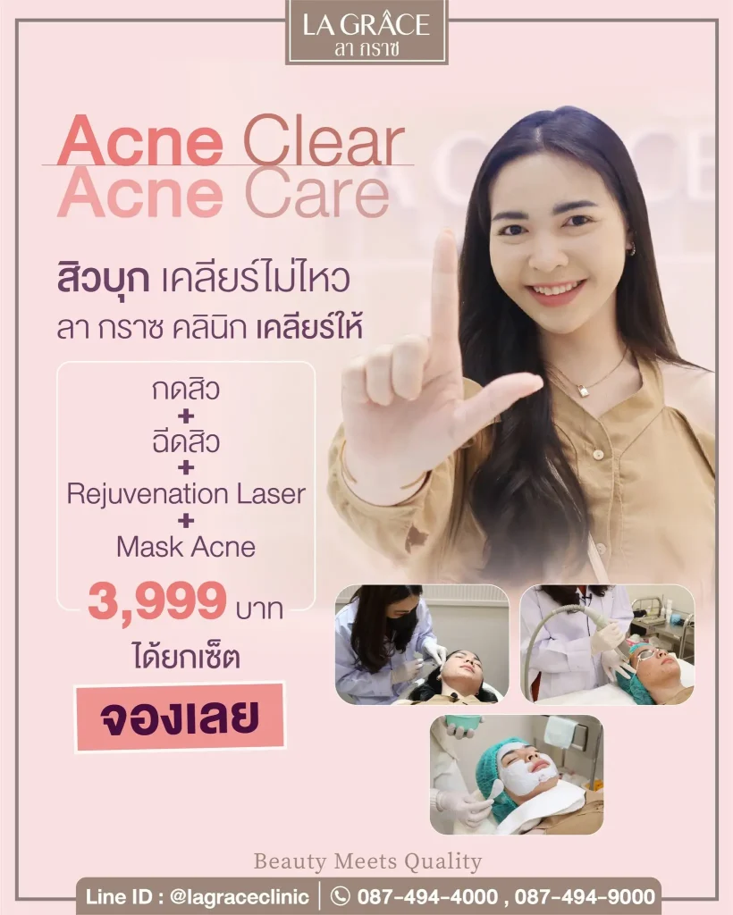 Acne Clear Promotion