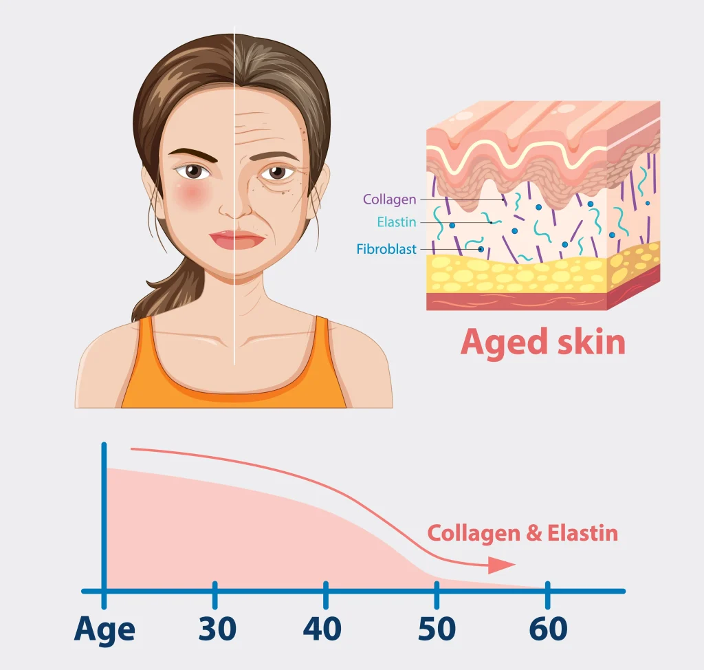 fibroblast