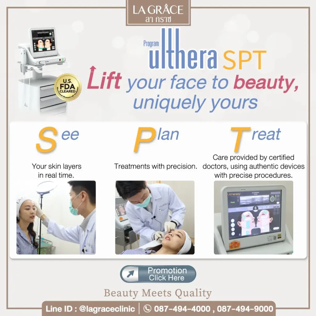 Ulthera SPT