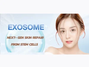 Exosome