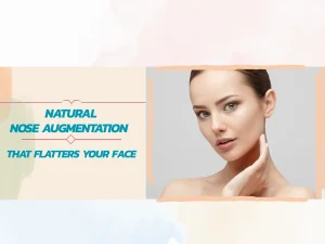Nose Aucmentation