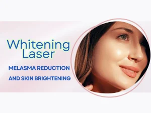 Whitening Laser