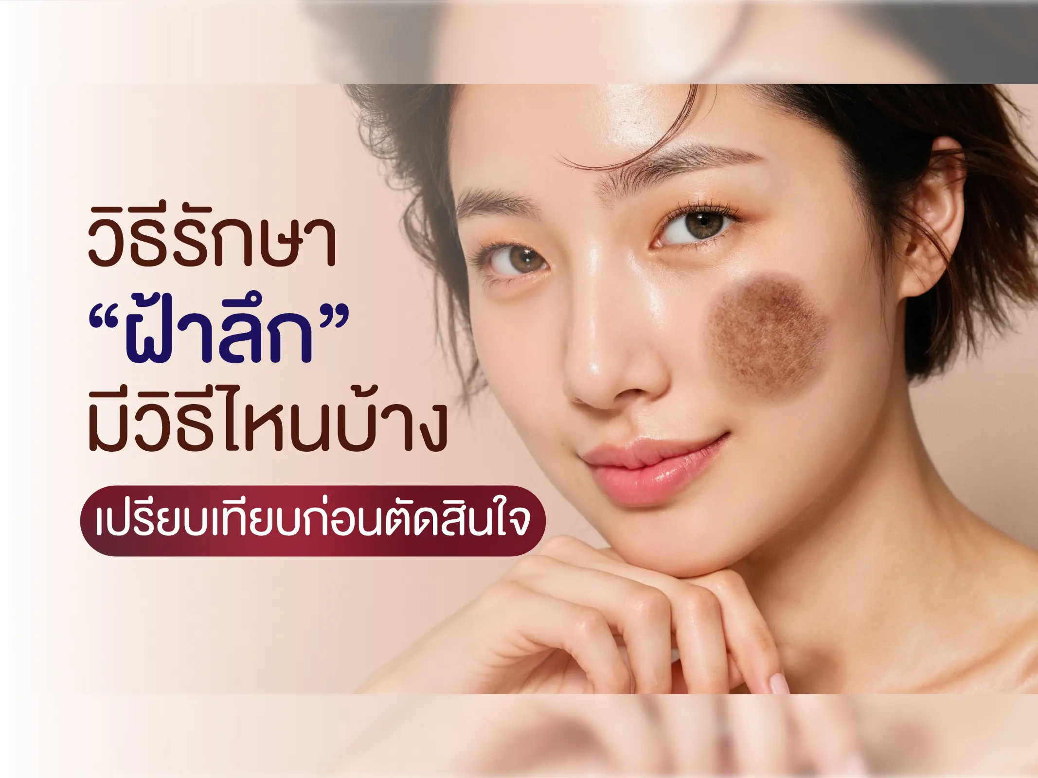 วิธีรักษาฝ้าลึก