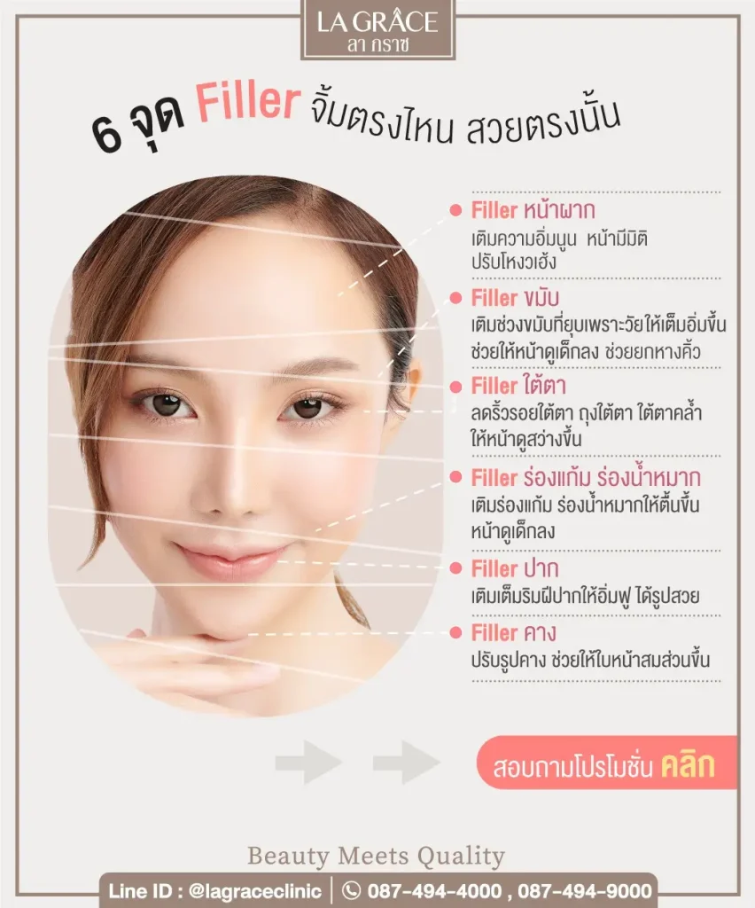 โปรแกรมฉีดฟิลเลอร์