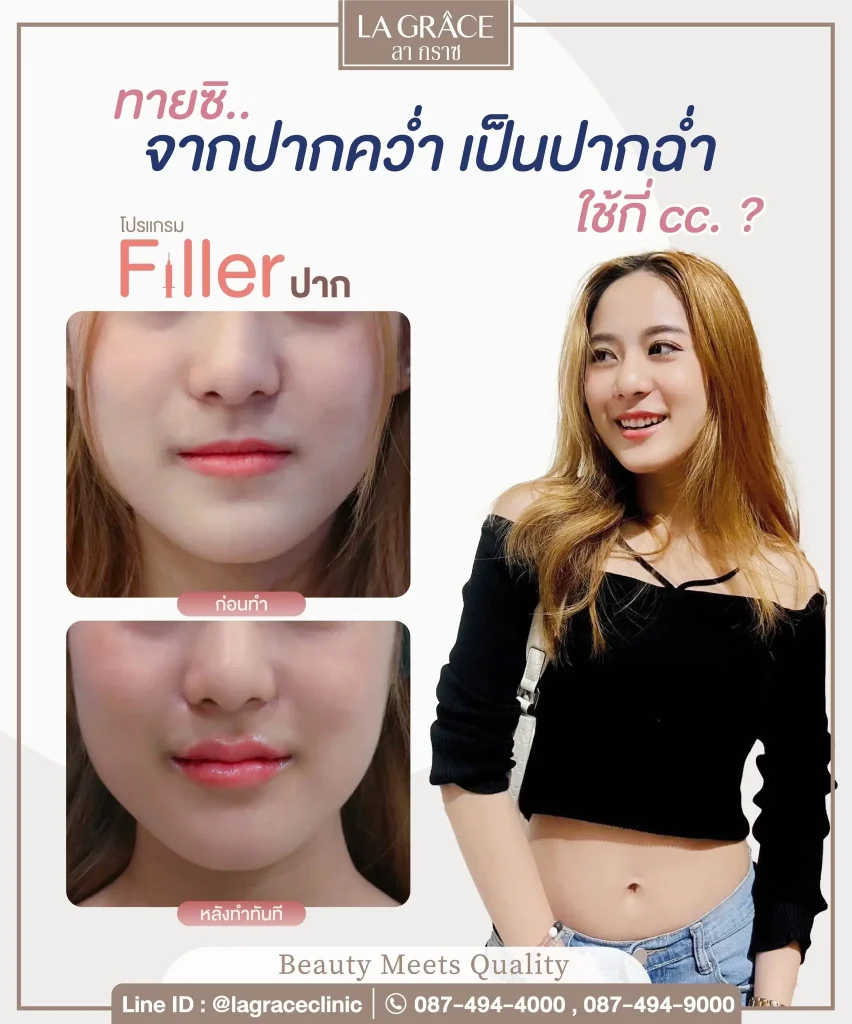 โปรแกรมฉีดฟิลเลอร์