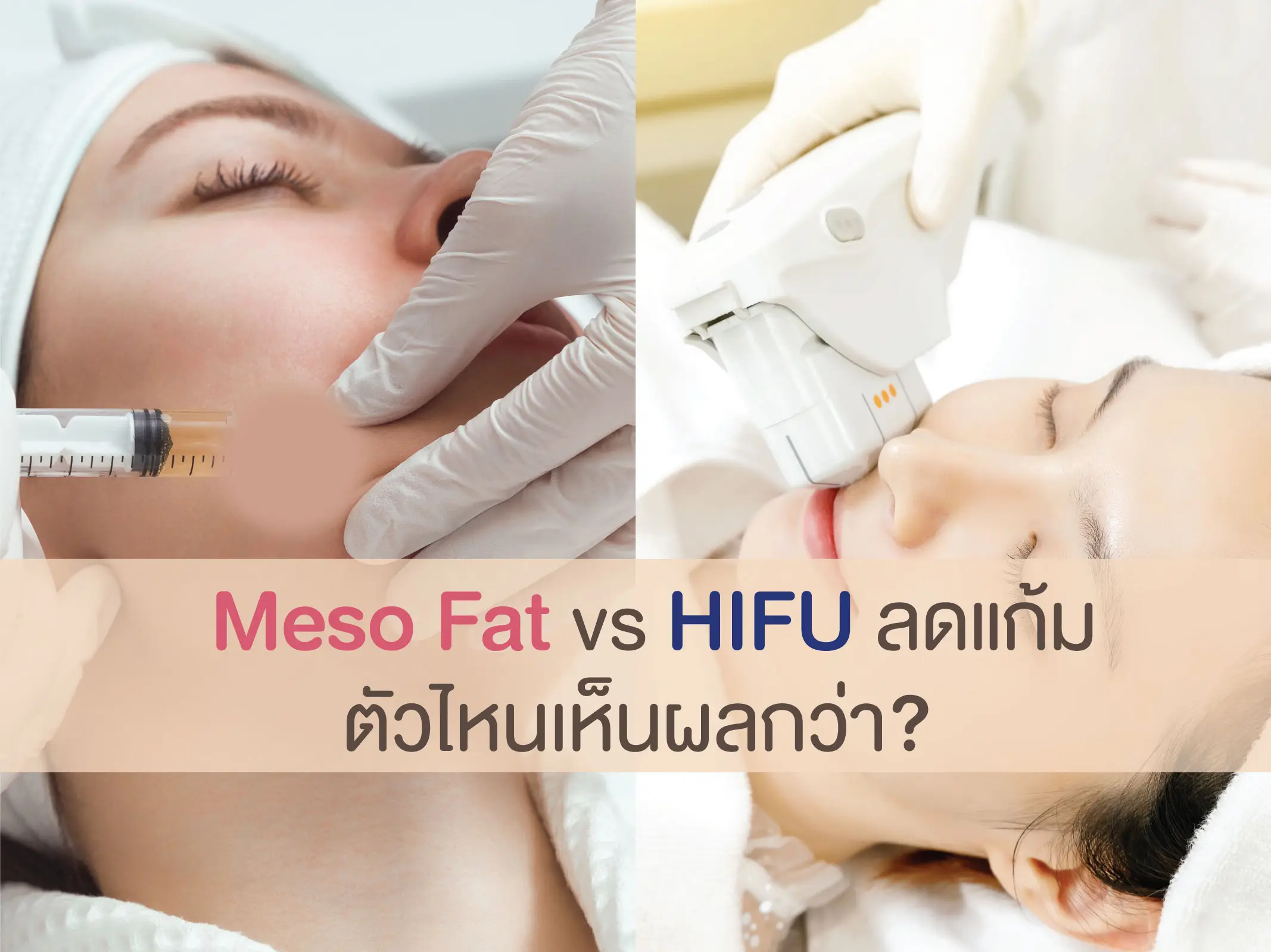 Meso Fat vs HIFU ลดแก้ม