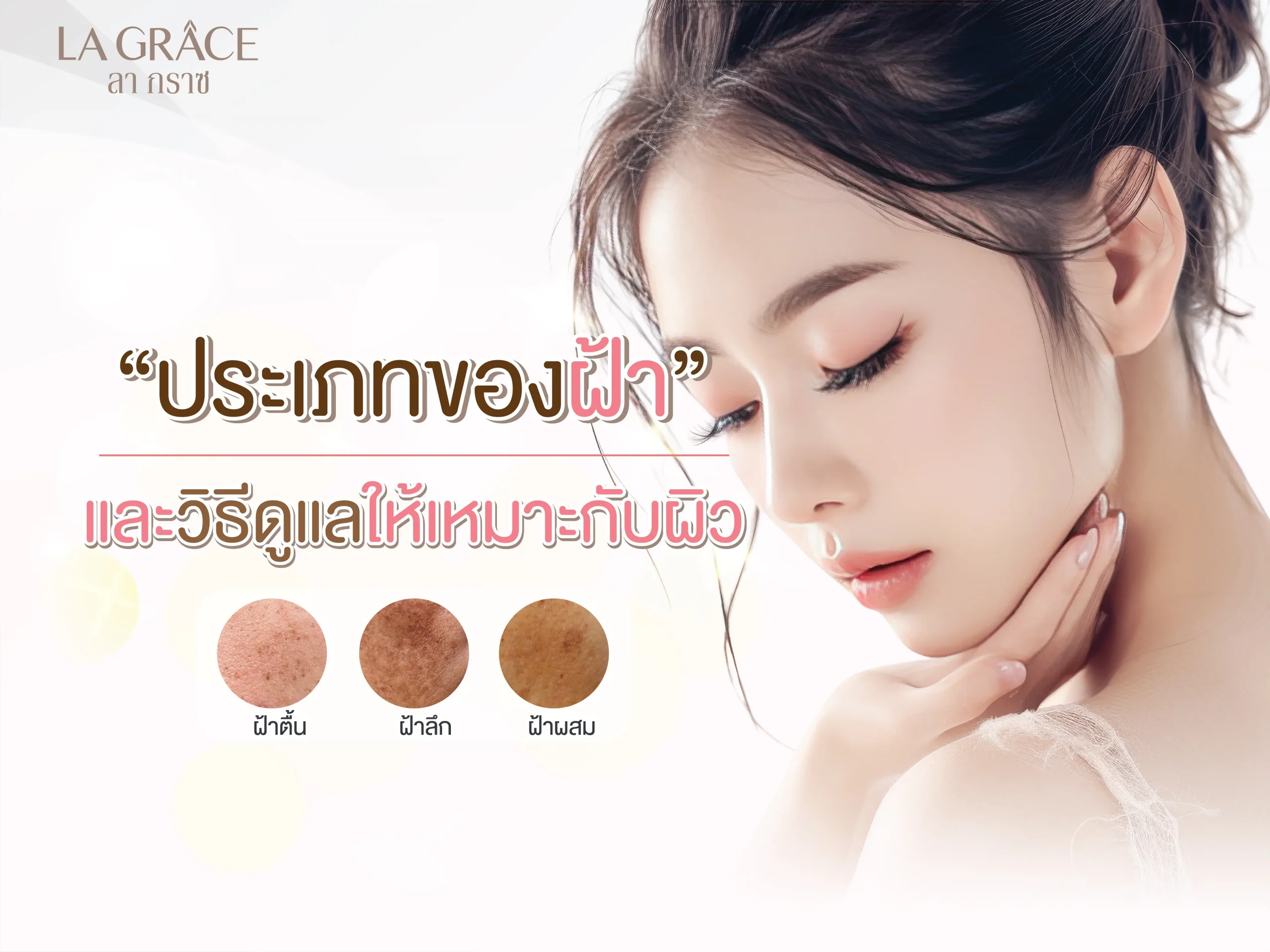 ประเภทของฝ้า