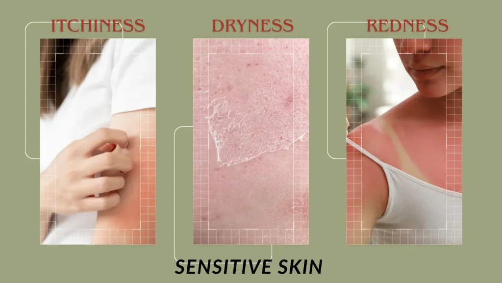 sensitive skin