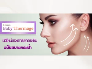 ยกกระชับฉบับสบายกระเป๋า Baby Thermage