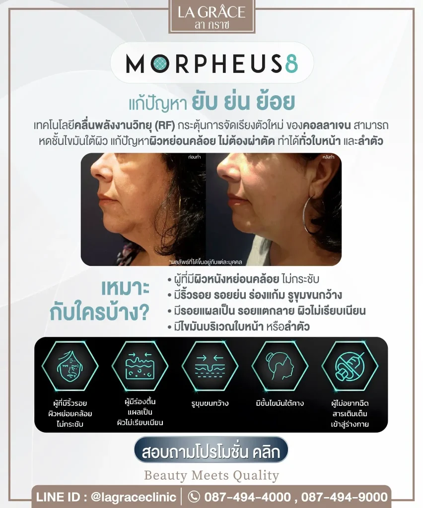Morpheus 8 เหมาะกับใคร