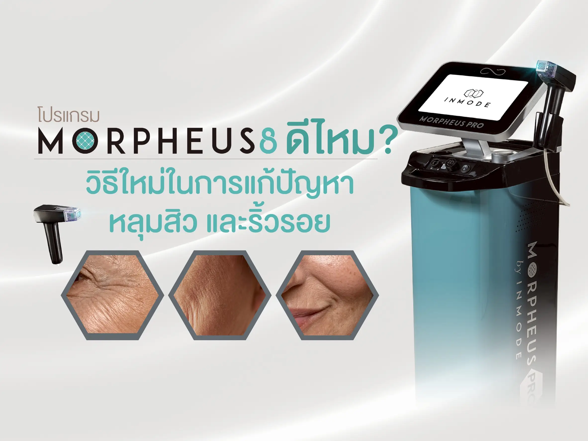 Morpheus 8 ดีไหม?