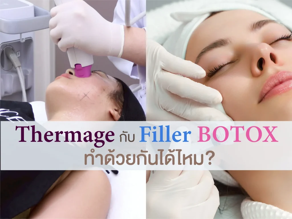 Thermage กับ Filler Botox ทำด้วยกันได้ไหม?