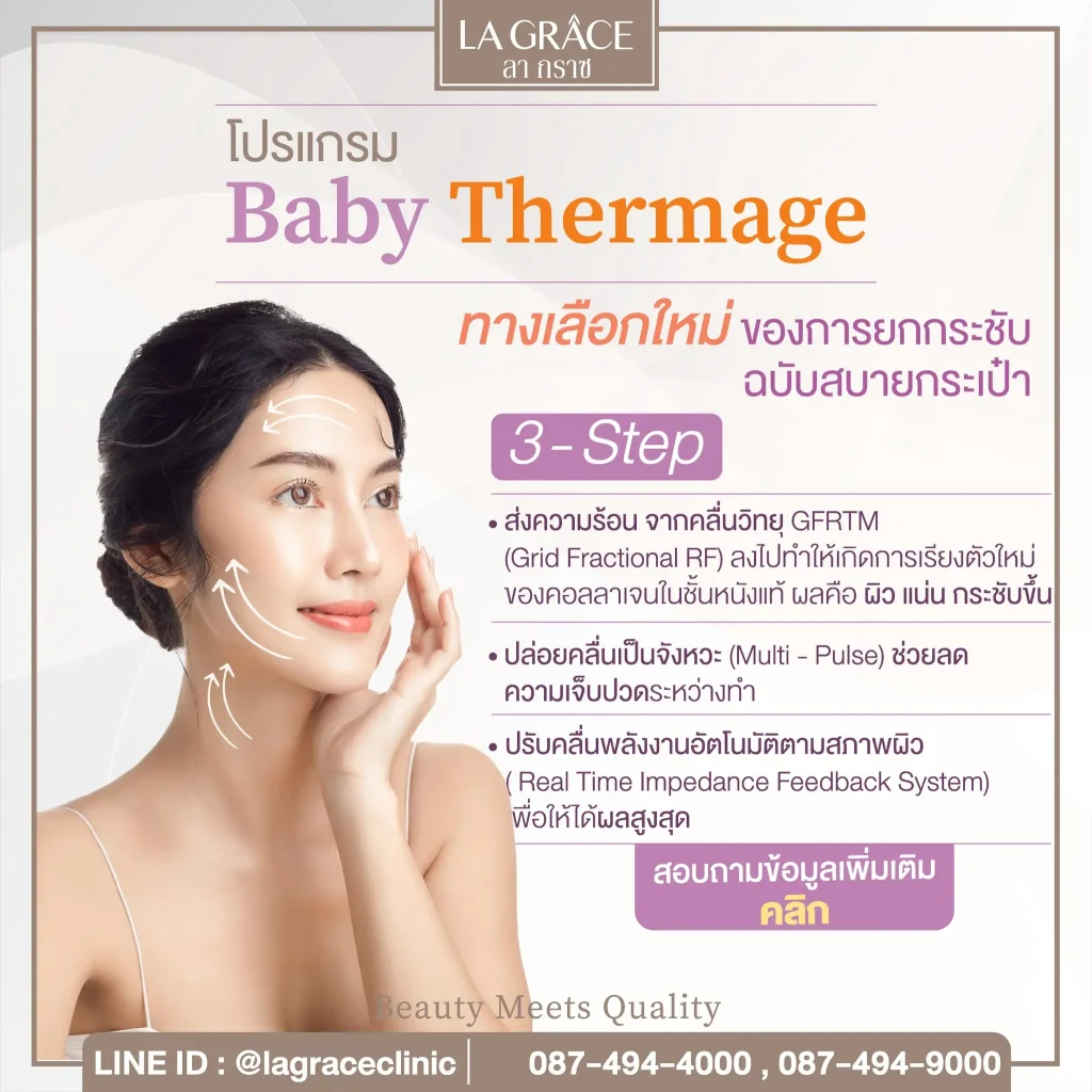 ยกกระชับฉบับสบายกระเป๋า Baby Thermage