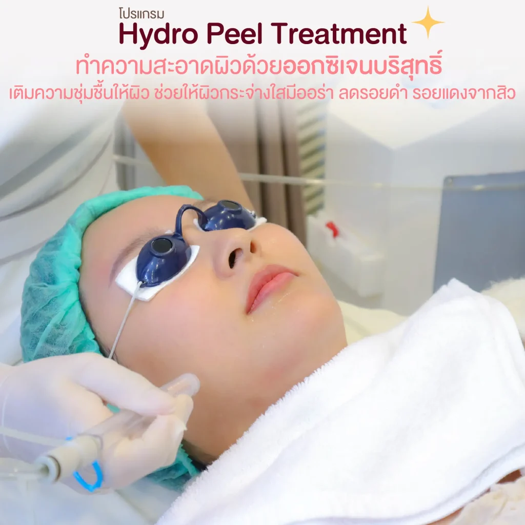 ทรีตเมนต์ผิว   Hydro Peel