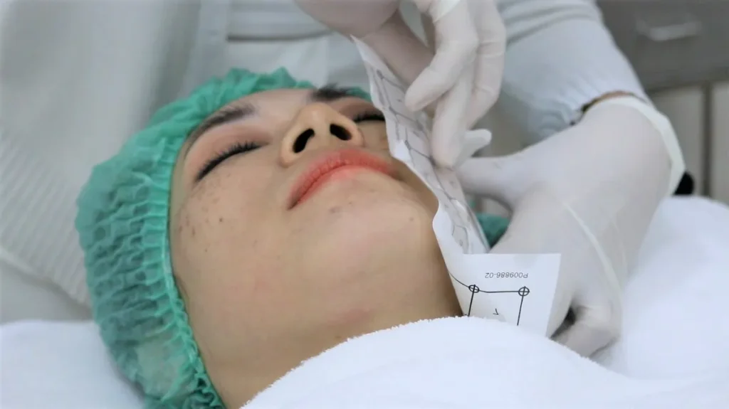 ยกกระชับหน้าแบบไม่ผ่าตัด 