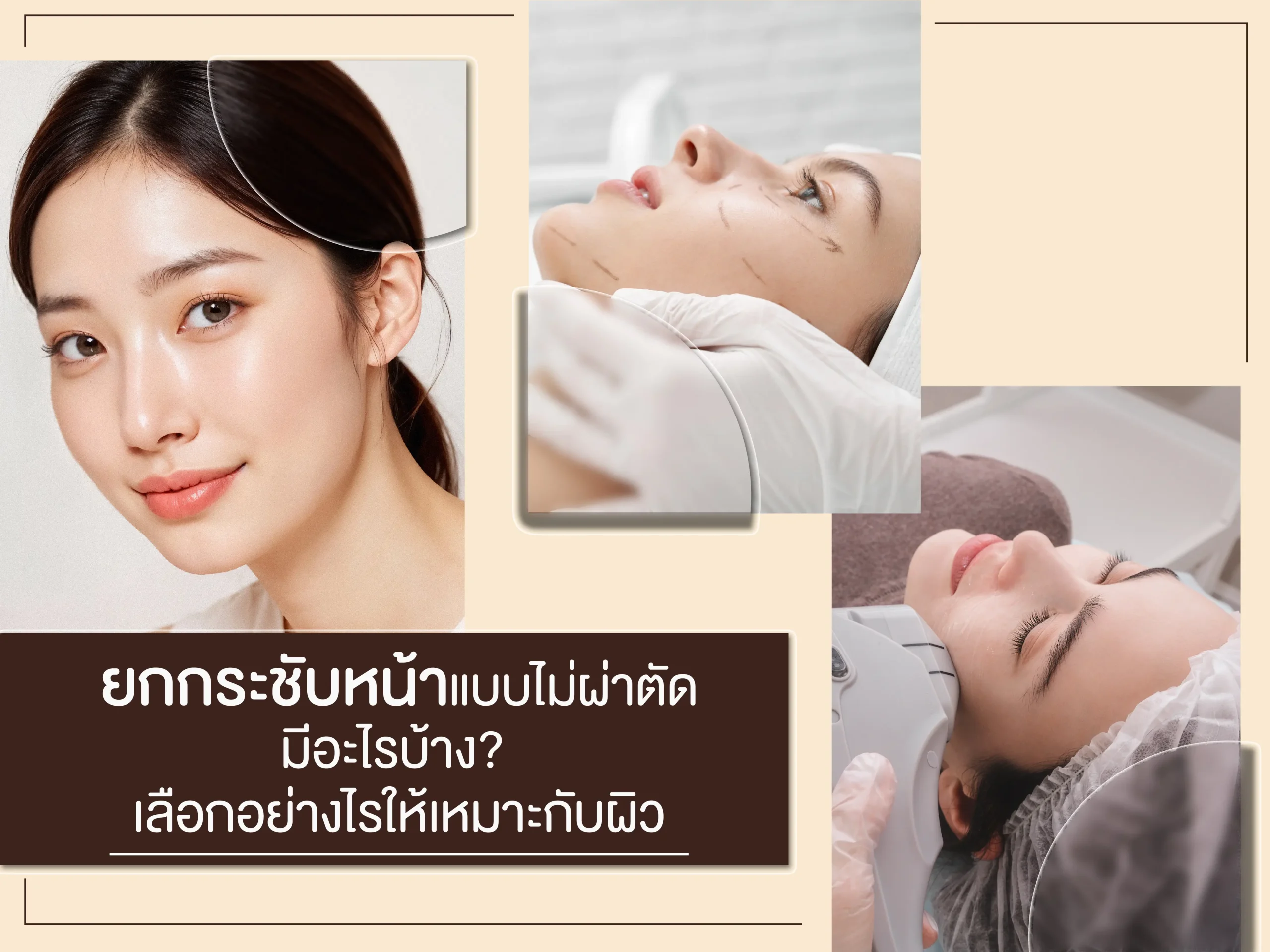 ยกกระชับหน้าแบบไม่ผ่าตัด