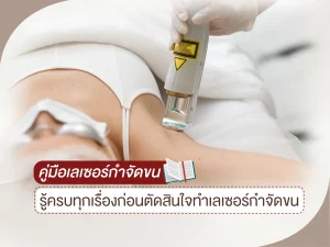 คู่มือเลเซอร์กำจัดขน