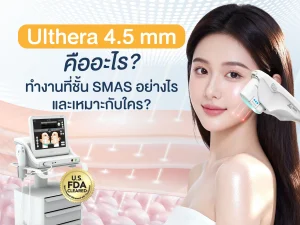 Ulthera 4.5 mm