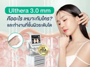 Ulthera 3.0 mm