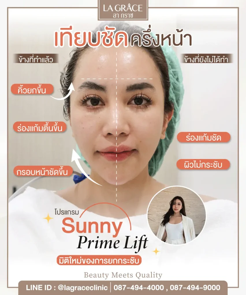 Sunny Prime Lift