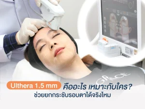 อัลเทอร่า 1.5 mm