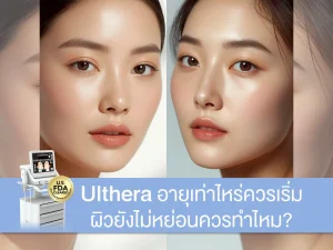 Ulthera อายุเท่าไหร่ควรเริ่ม