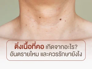 ติ่งเนื้อที่คอ