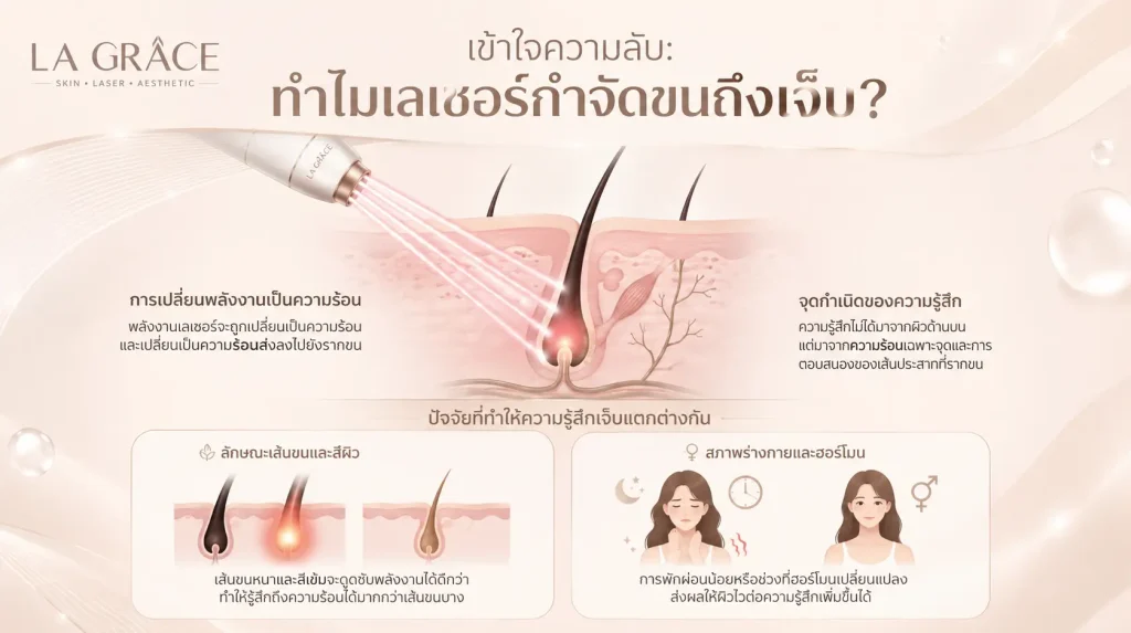 เลเเซอร์กำจัดขนเจ็บไหม : infographic อธิบายกลไกการทำงานของ เลเซอร์ขน และปัจจัยที่มีผลต่อความเจ็บ