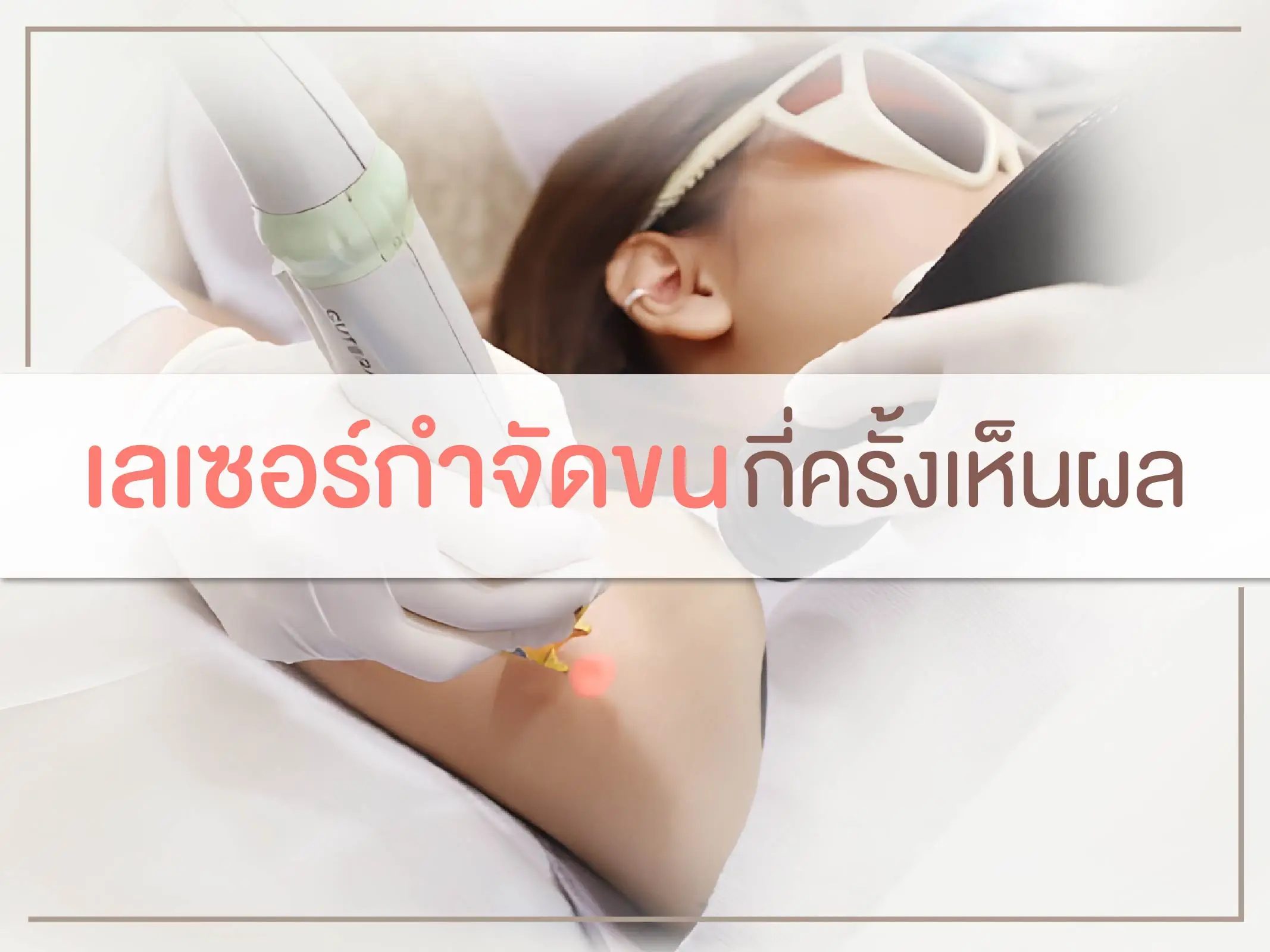 เลเซอร์กำจัดขน กี่ครั้งเห็นผล