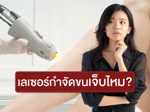 เลเซอรฺกำจัดขนเจ็บไหม