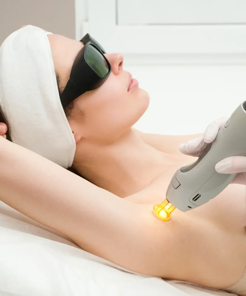 เลเซอร์กำจัดขนรักแร้ เห็นผลเร็วที่สุด
laser hair removal underarm fast results