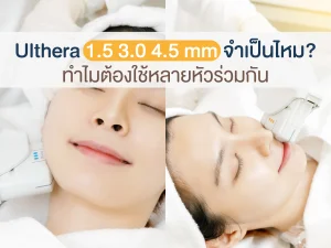 Ulthera 1.5 3.0 4.5 mm