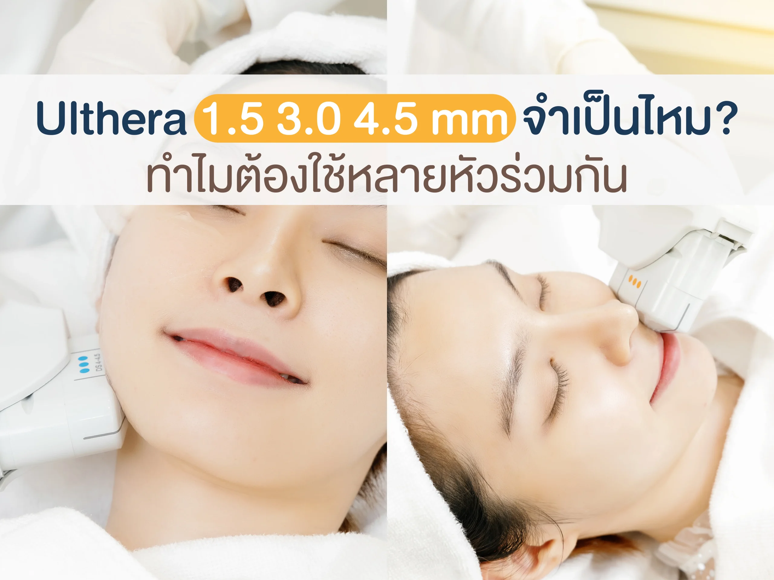 Ulthera 1.5 3.0 4.5 mm