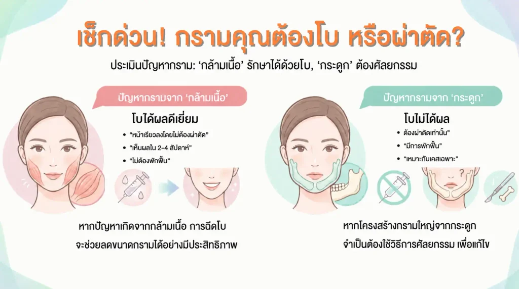 กรามใหญ่แบบไหน ควรฉีด โบ