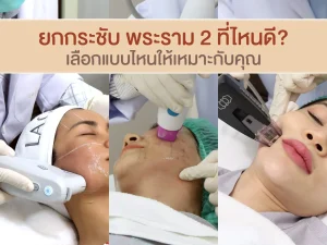 ยกกระชับ พระราม 2 เปรียบเทียบ Ulthera Thermage และ Morpheus 8