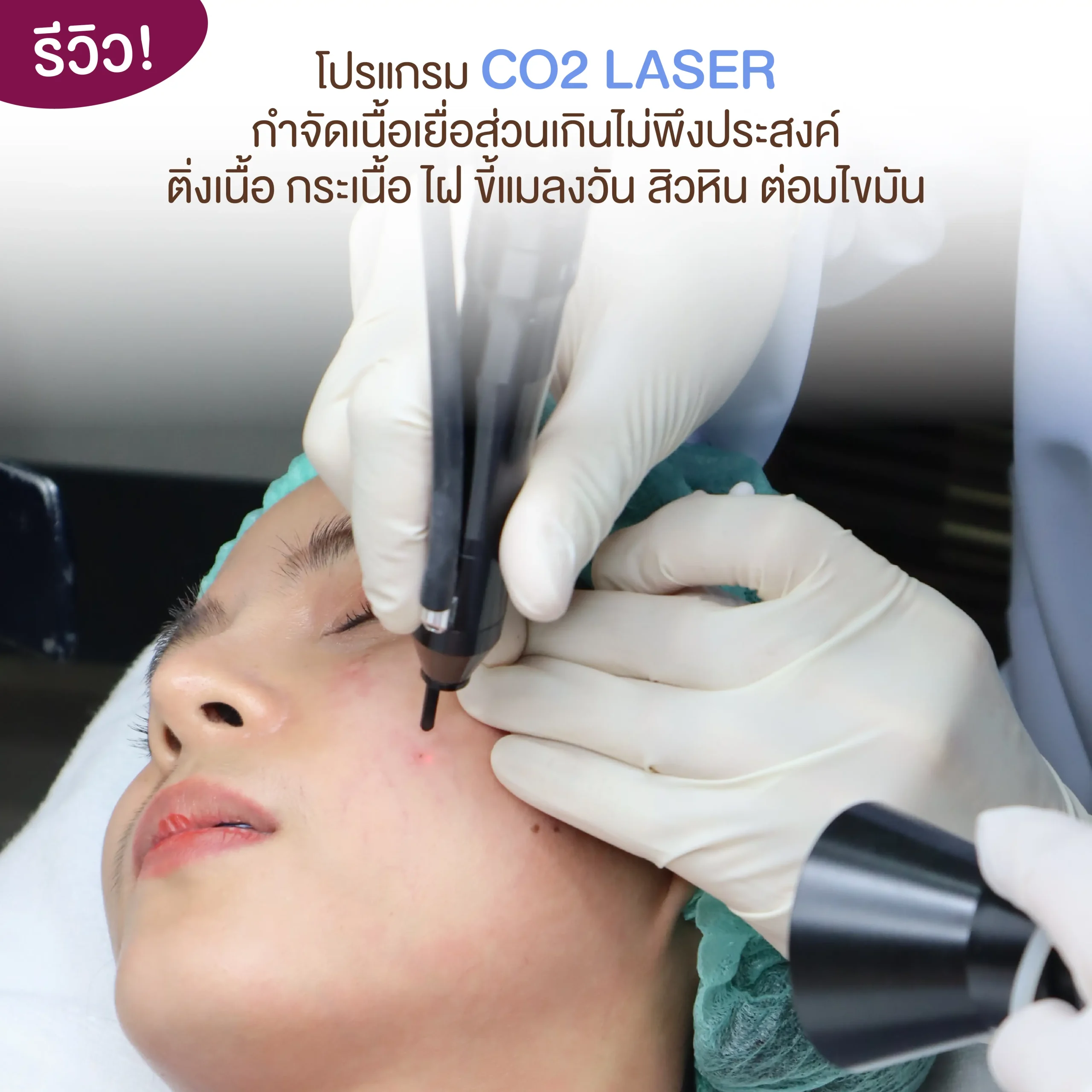 รีวิว co2 -01