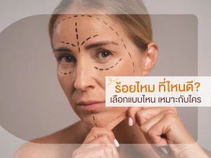 ร้อยไหม ที่ไหนดี