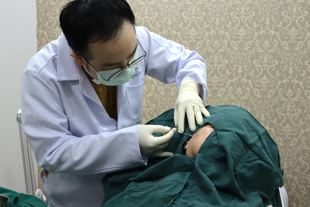 ขั้นตอนการ ร้อยไหม ยกกระชับใบหน้าโดยแพทย์