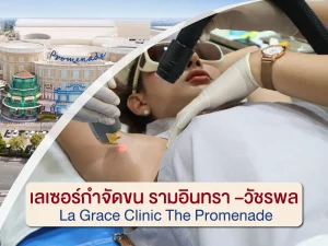 เลเซอร์กำจัดขน รามอินทรา