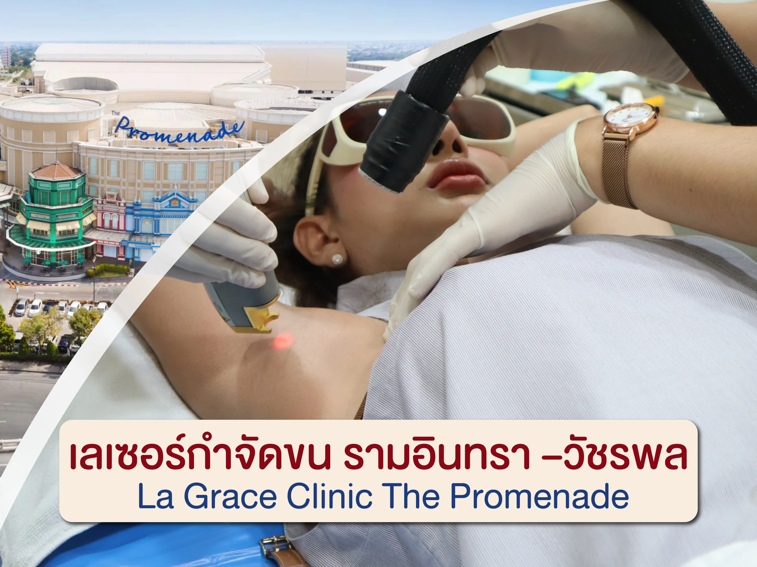 เลเซอร์กำจัดขน รามอินทรา