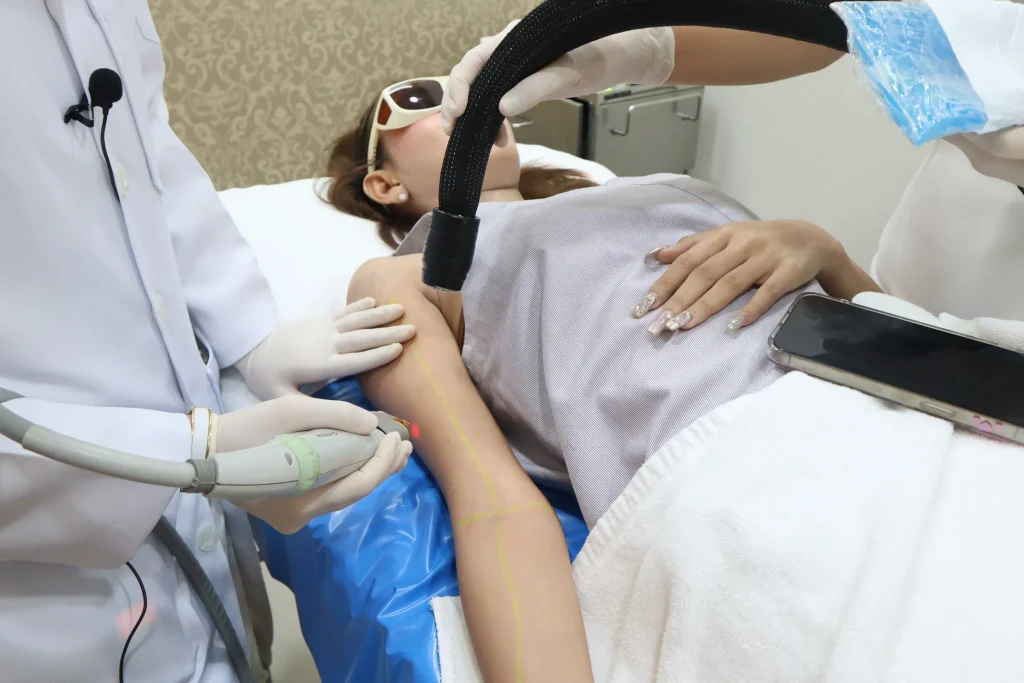 เลเซอร์กำจัดขนแขน พร้องเครื่องเป่าลมเย็น เพื่อความสบายขณะทำ