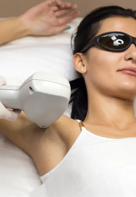 เลเซอร์กำจัดขน