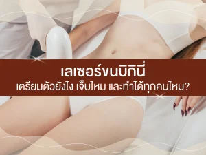 เลเซอร์ขนบิกินี่